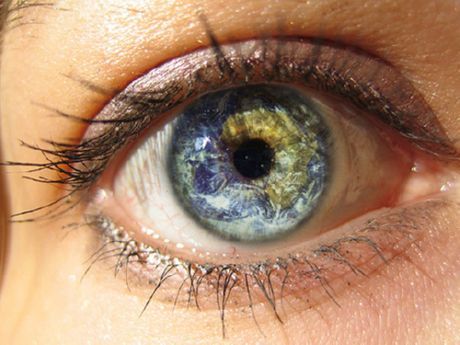 Corneal ulcer