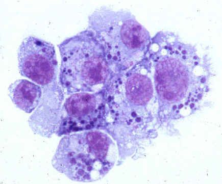 Mga sanhi ng ahente ng anaplasmosis ng tao (pamilya Anaplasmataceae)