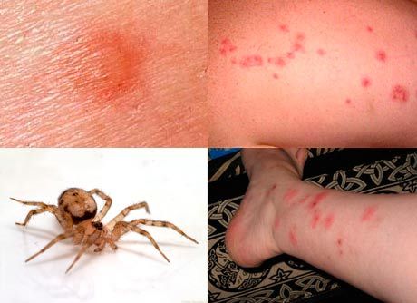Home Spider 
