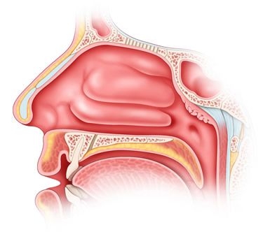 Vasomotor rhinitis