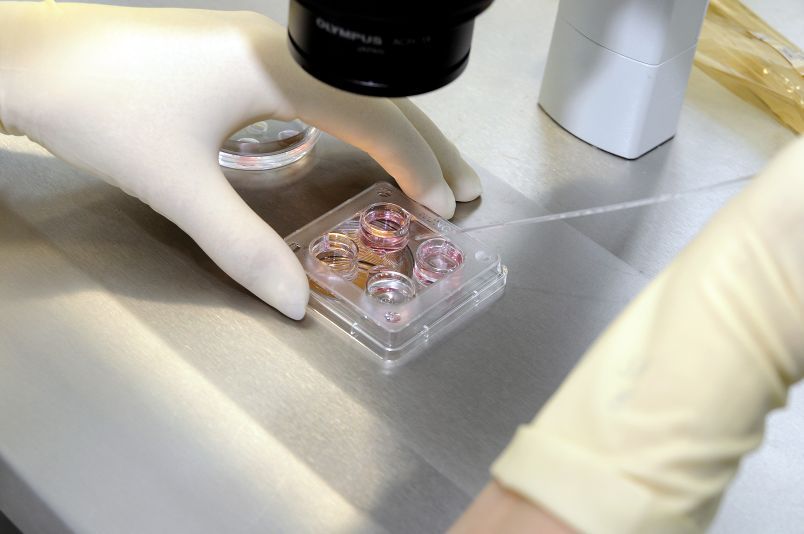 Sa nakalipas na 34 na taon, 5 milyong "test tube babies" ang ipinanganak.